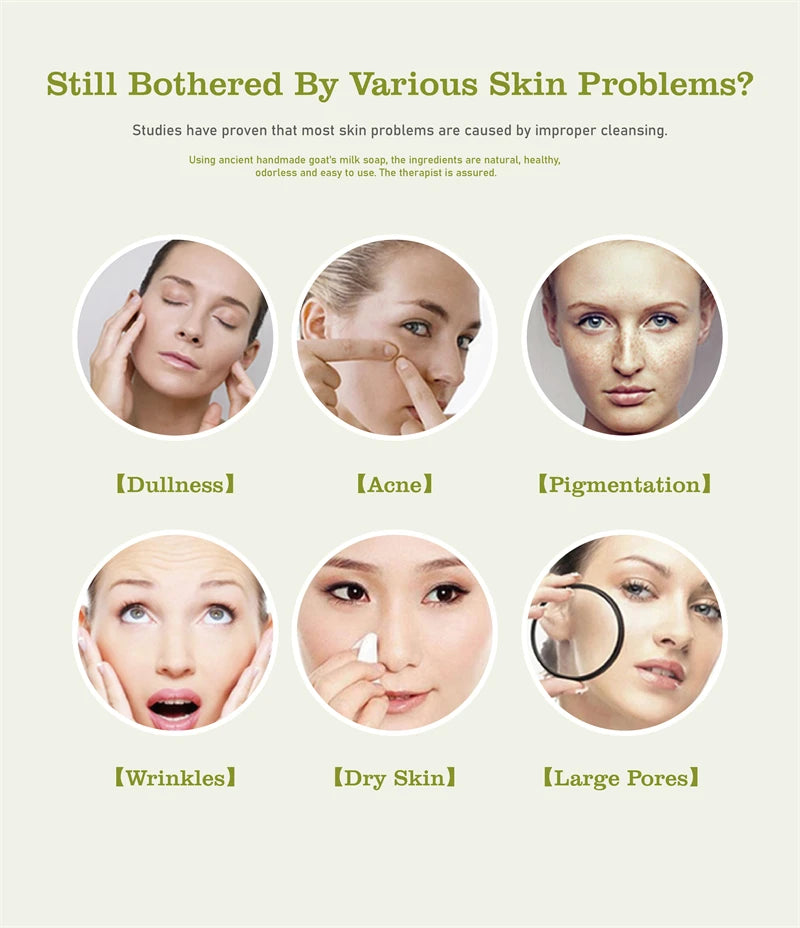 Head to Toes Whitening Soap Underarm Knee Bleaching Soap Chicken Skin Removal Dark Spot Removal Dead Skin Moisturize Brighten Body Care