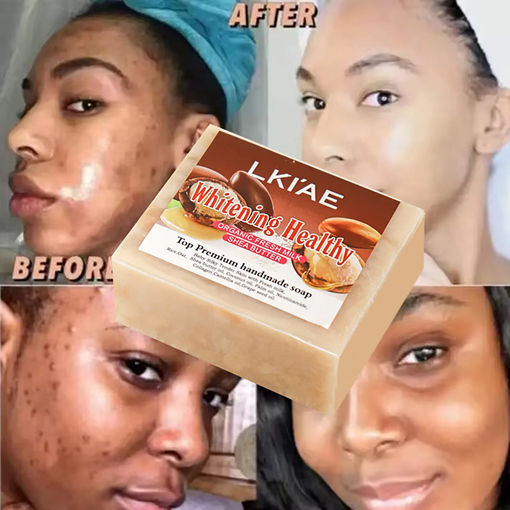 Deep Cleaning Organic Fresh Milk Whitening Soap Bar, Lighten, Improve Skin Elasticity, Handmade Soap For Face, Body and Hands, 150g/5.3 oz
