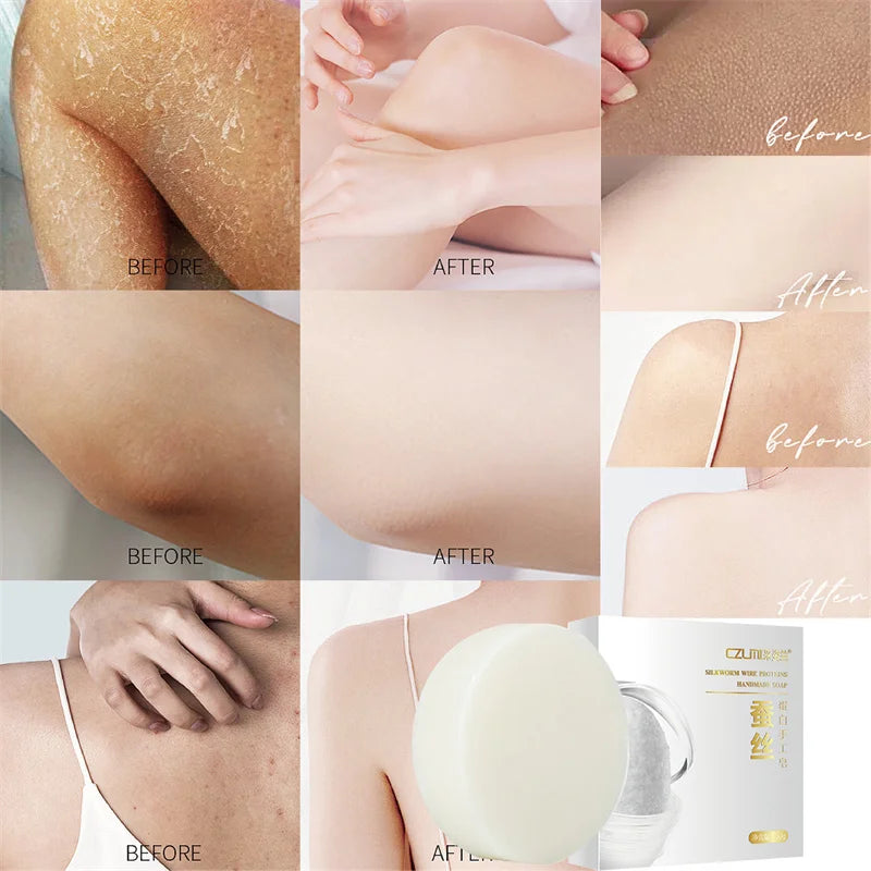 Head to Toes Whitening Soap Underarm Knee Bleaching Soap Chicken Skin Removal Dark Spot Removal Dead Skin Moisturize Brighten Body Care