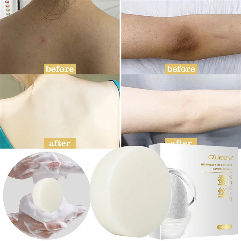 Head to Toes Whitening Soap Underarm Knee Bleaching Soap Chicken Skin Removal Dark Spot Removal Dead Skin Moisturize Brighten Body Care