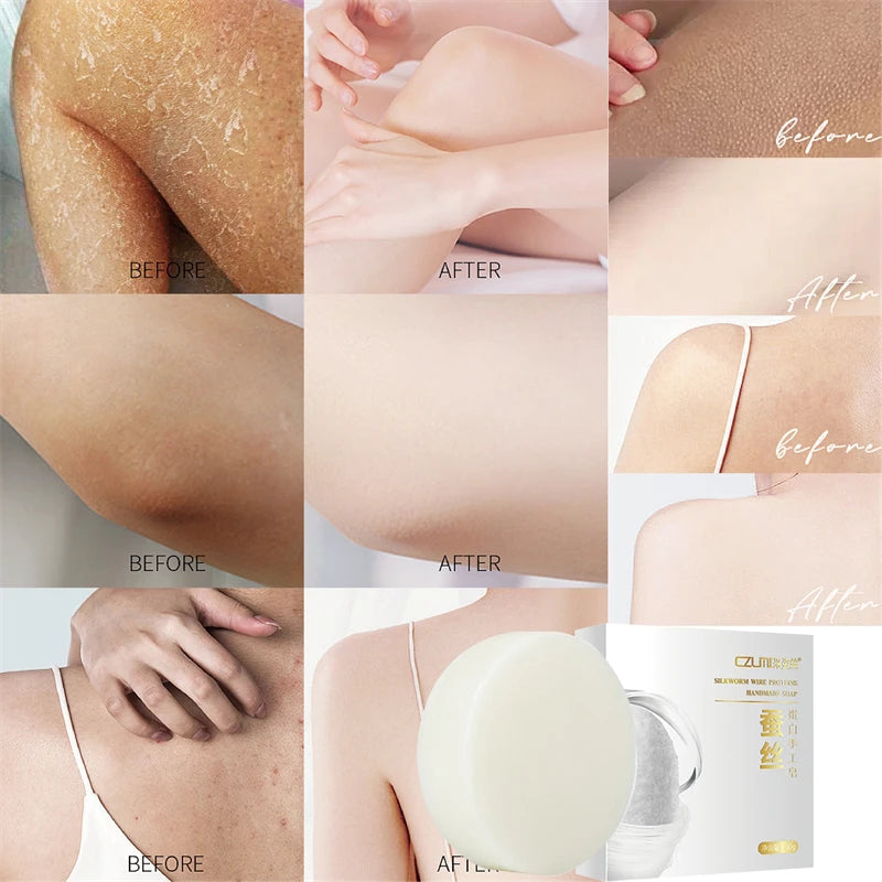 Head to Toes Whitening Soap Underarm Knee Bleaching Soap Chicken Skin Removal Dark Spot Removal Dead Skin Moisturize Brighten Body Care