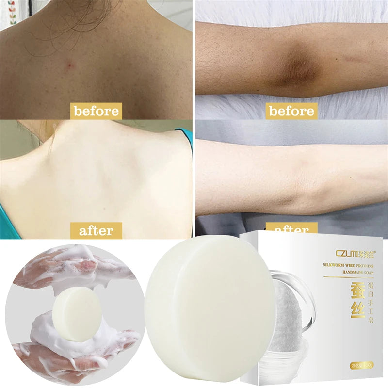 Head to Toes Whitening Soap Underarm Knee Bleaching Soap Chicken Skin Removal Dark Spot Removal Dead Skin Moisturize Brighten Body Care